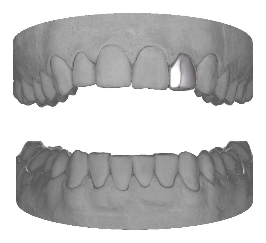 Lateral