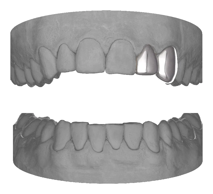 Lateral Canine