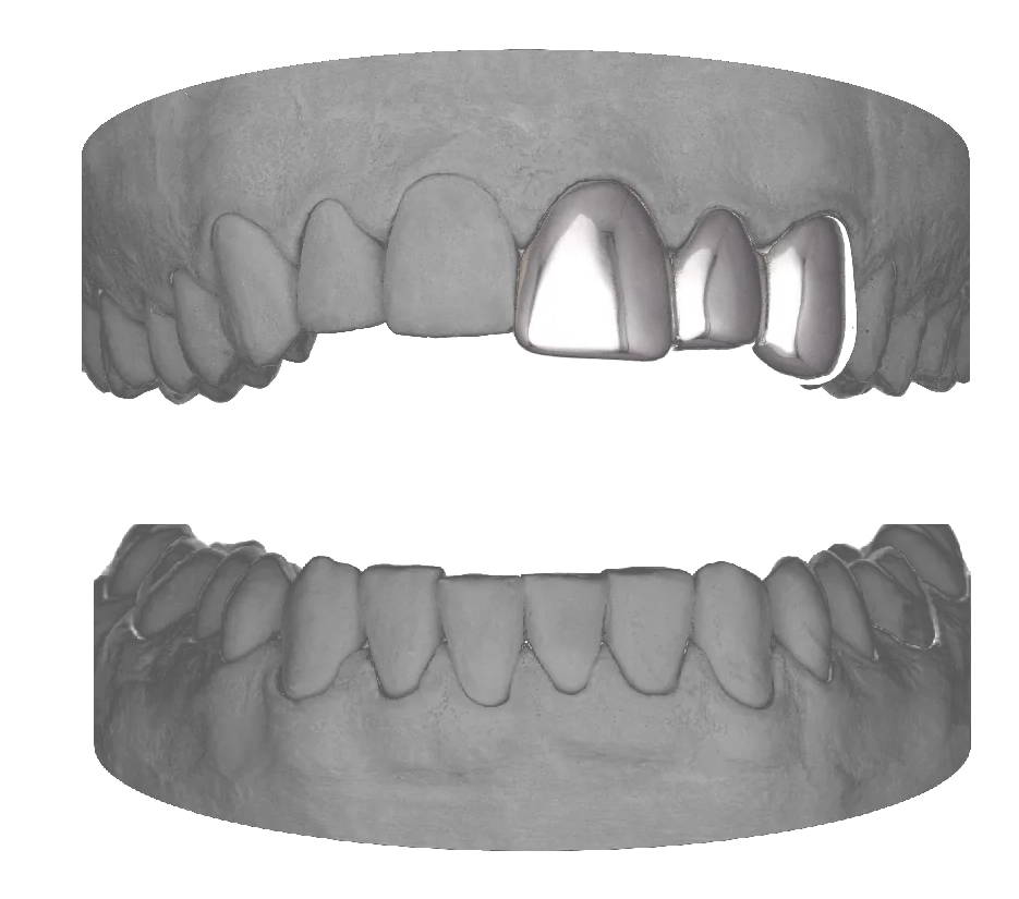 Central Lateral Canine