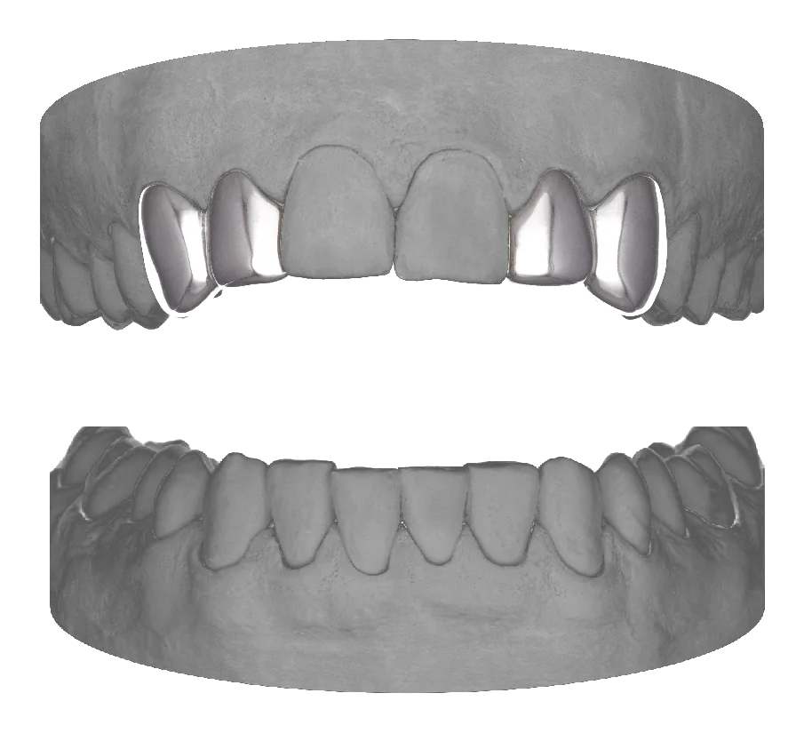 2x Lateral Canine