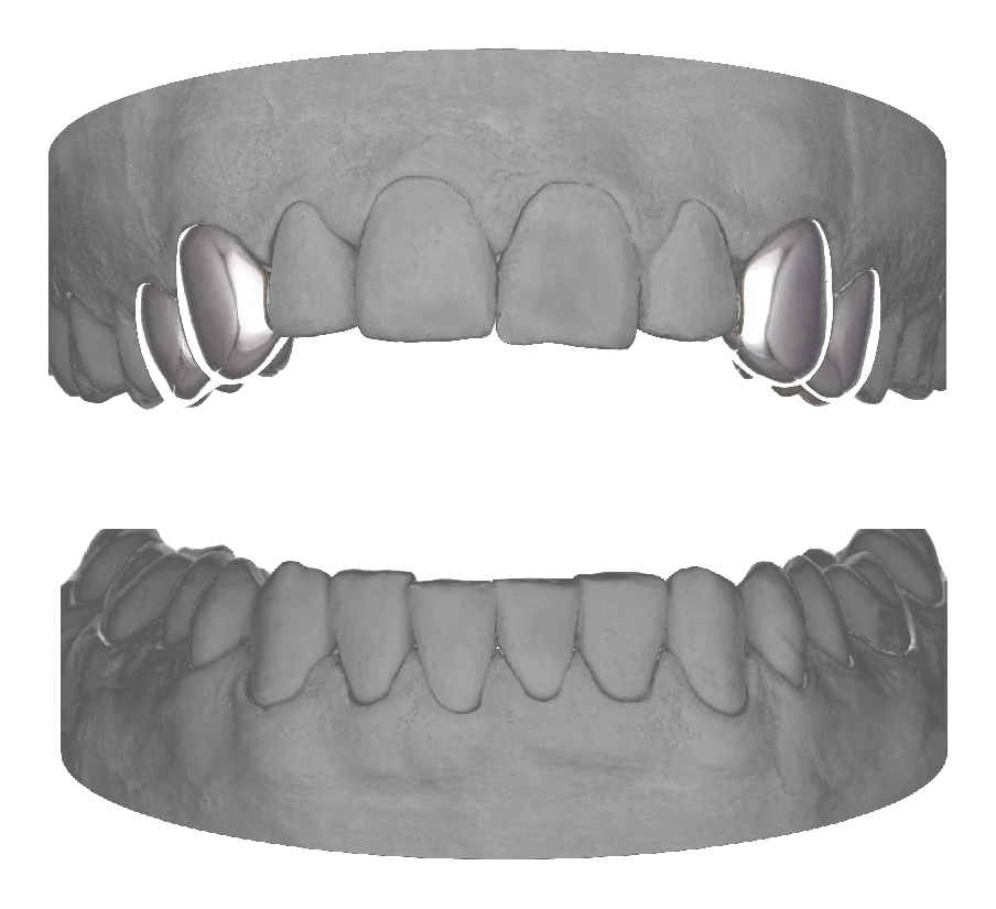2x Premolar Canine