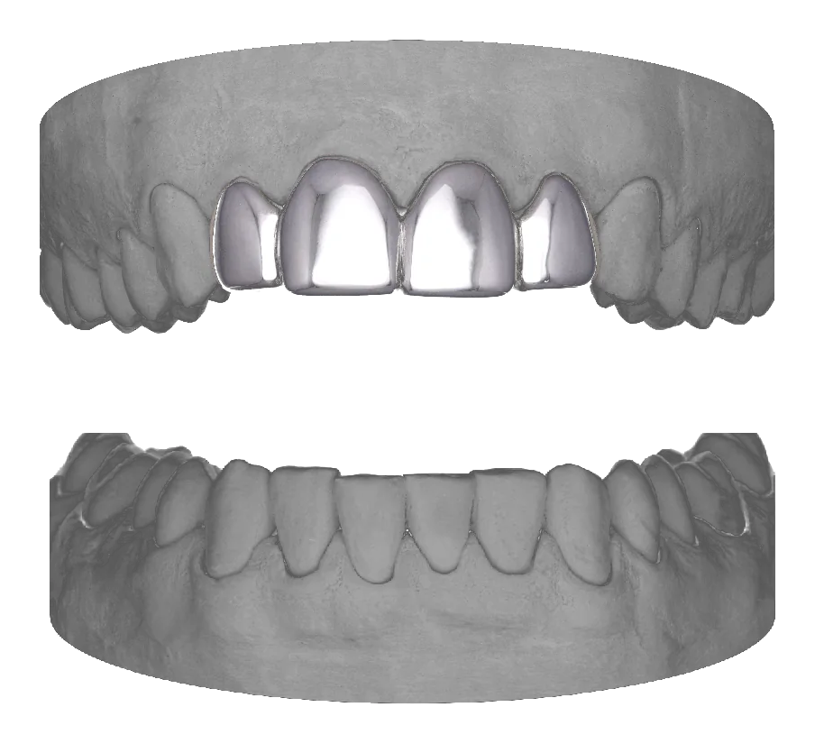 4 Set Upper