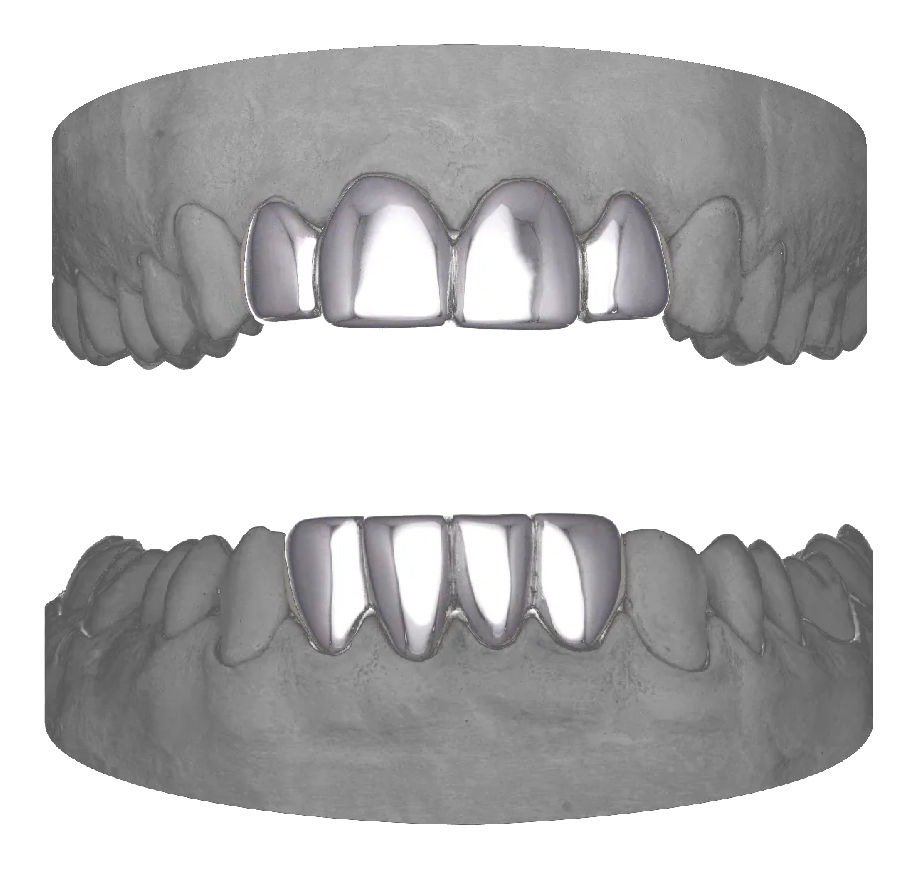 4 Set Upper & Lower