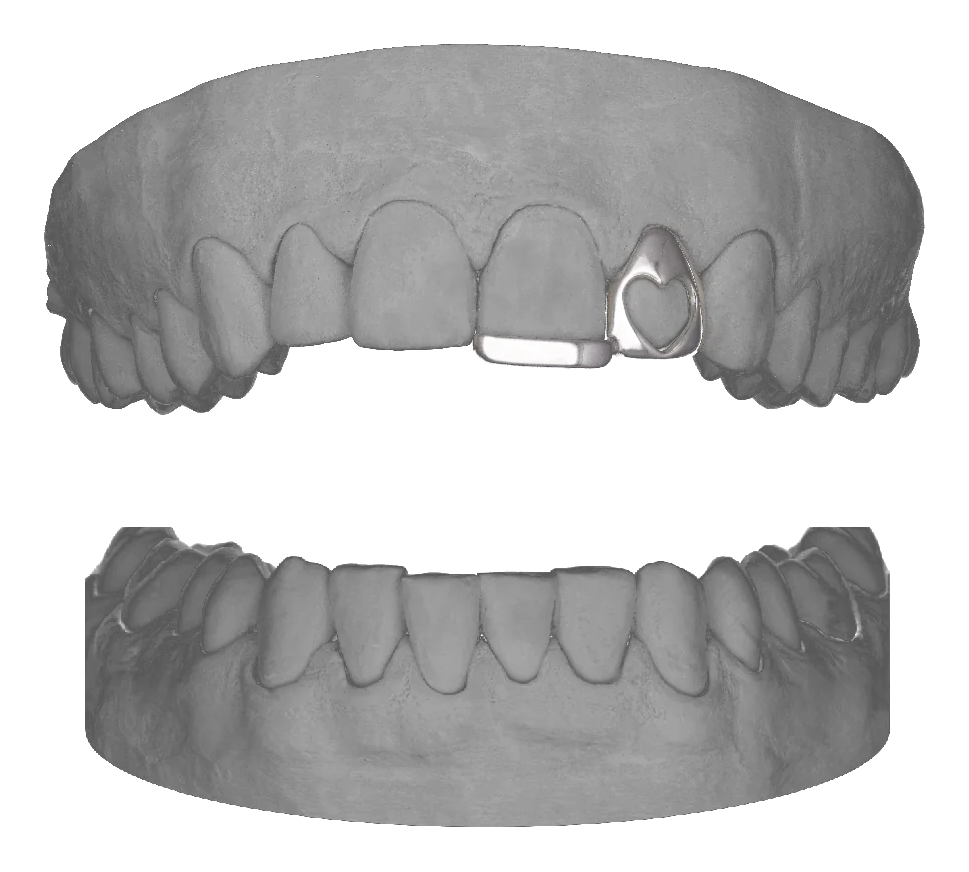 Heart Lateral Bar
